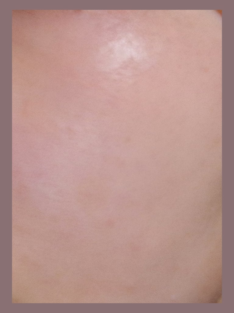 ジンクテカBセラムセット/BRING GREEN/スキンケアキットを使ったクチコミ(2枚目)