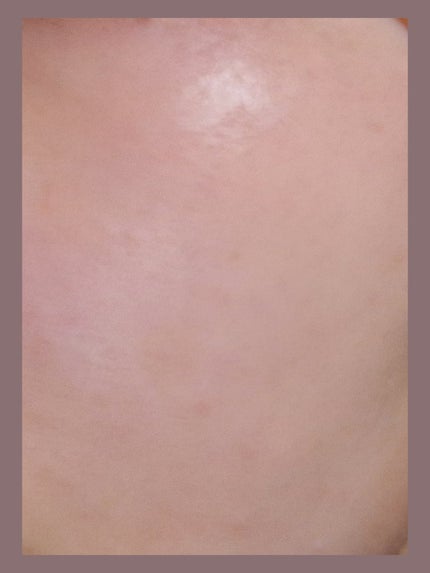 ジンクテカBセラムセット/BRING GREEN/スキンケアキットを使ったクチコミ(2枚目)