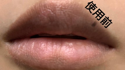 ニードルプランパー 電撃チェリー/Ui2./リッププランパーを使ったクチコミ(8枚目)