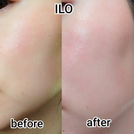 ILO ムチンコラーゲンゼリー/東亜製薬/美容サプリメントを使ったクチコミ(6枚目)