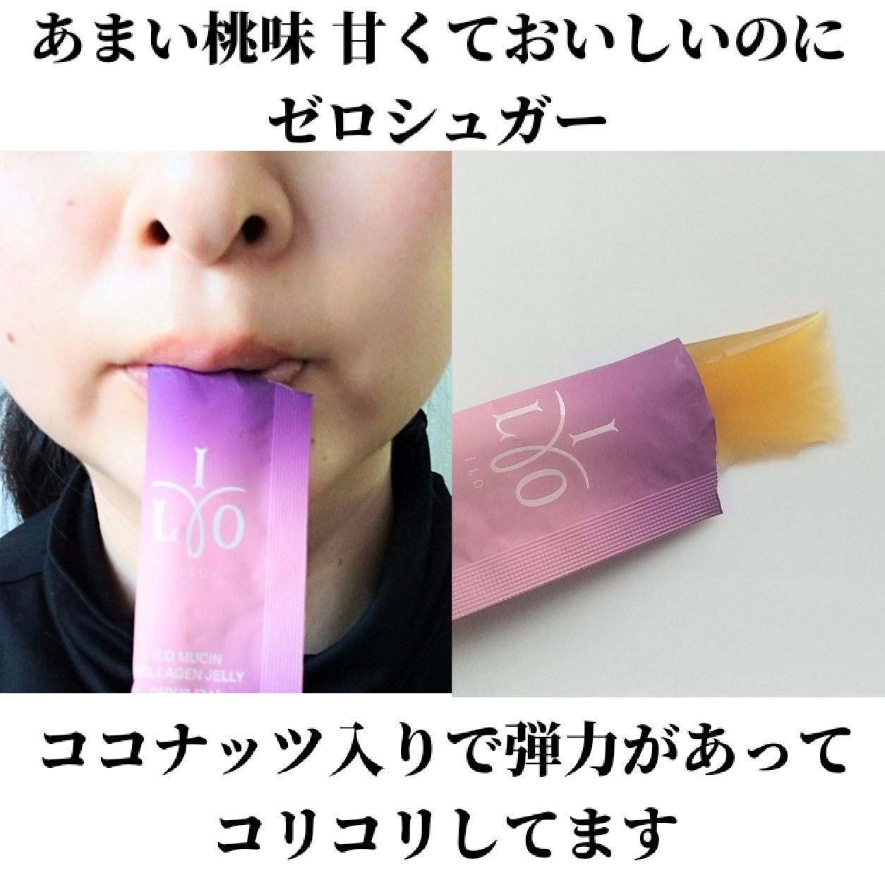 ILO ムチンコラーゲンゼリー/東亜製薬/美容サプリメントを使ったクチコミ(5枚目)