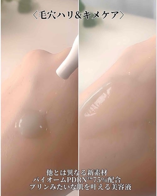 ReDRNエクソソームアンプル/Dr.nineteen/美容液を使ったクチコミ(6枚目)