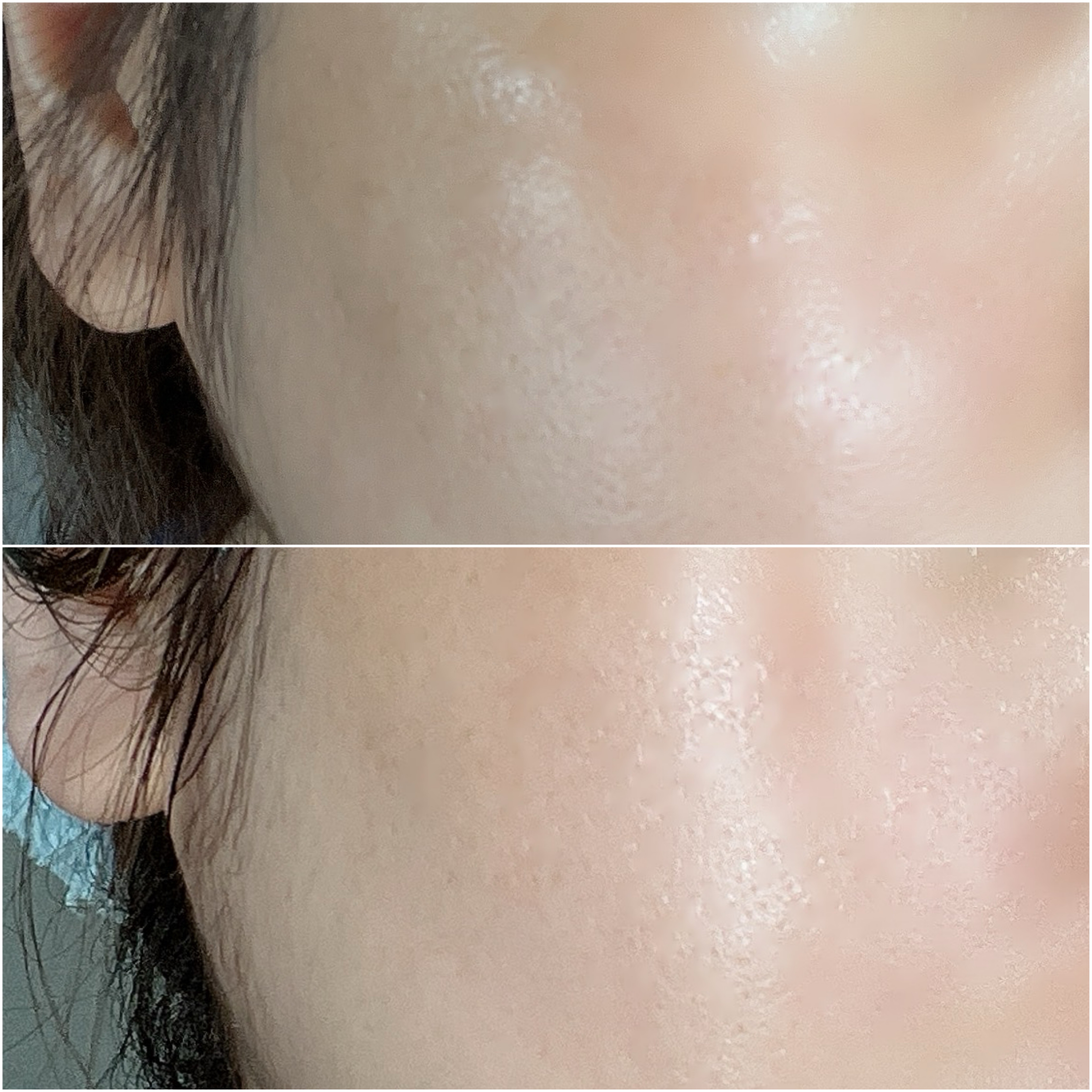 トラネキサム酸スキンブースタークリーム/MEDITHERAPY/フェイスクリームを使ったクチコミ（3枚目）