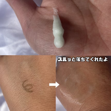 ベターツリカン肌荒れ美容液/Mildlab/美容液を使ったクチコミ(7枚目)