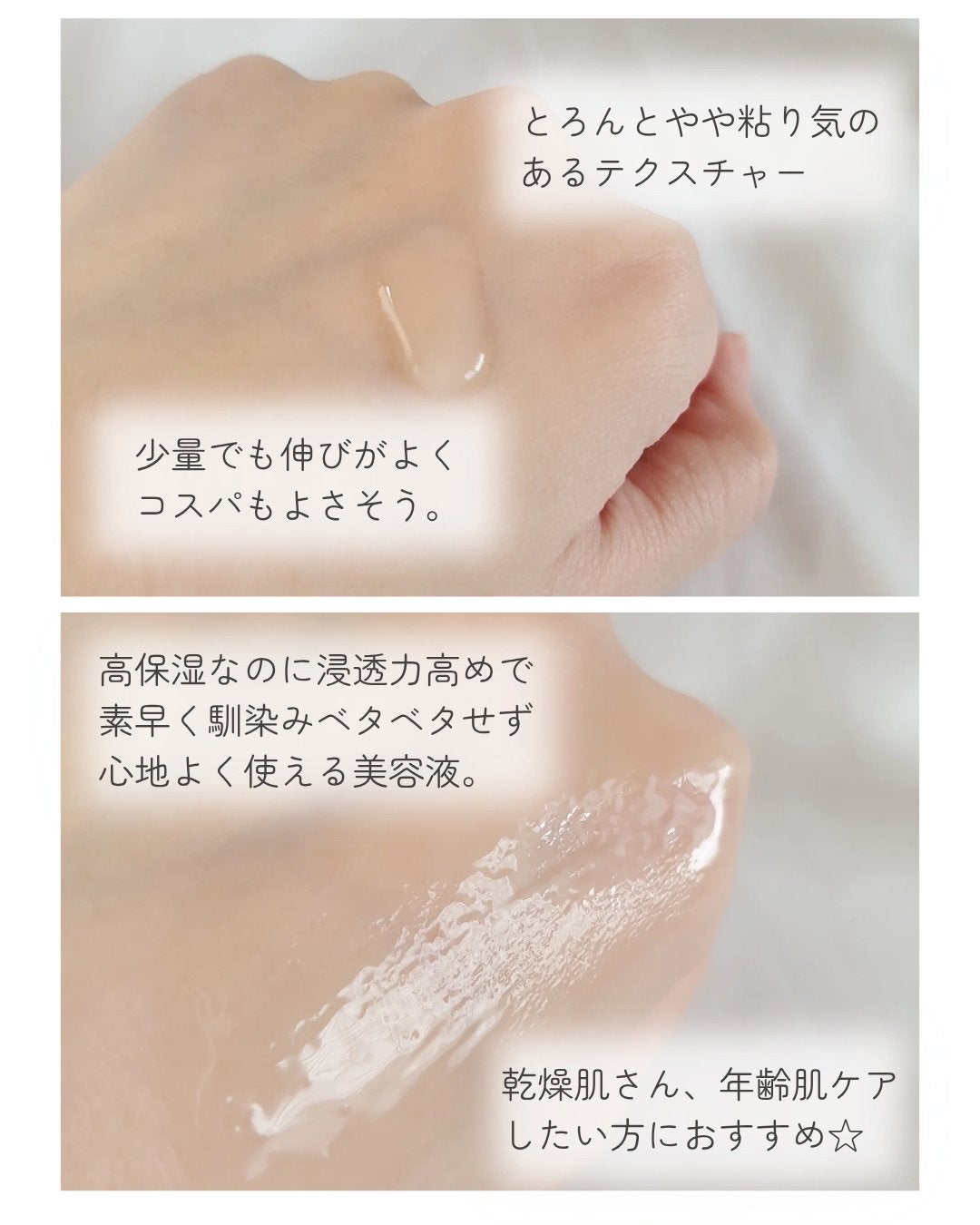 REJURAN ãã¥ã¢ã«ãšãã§ã¯ãã¢ã³ãã« 30ml/REJURAN COSMETICS/çŸå®¹æ¶²ã䜿ã£ãã¯ãã³ãïŒ3æç®ïŒ