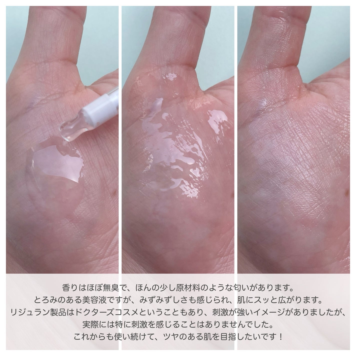 REJURAN ãã¥ã¢ã« ãšãã§ã¯ã ã¢ã³ãã« 30mL/REJURAN COSMETICS/çŸå®¹æ¶²ã䜿ã£ãã¯ãã³ãïŒ5æç®ïŒ