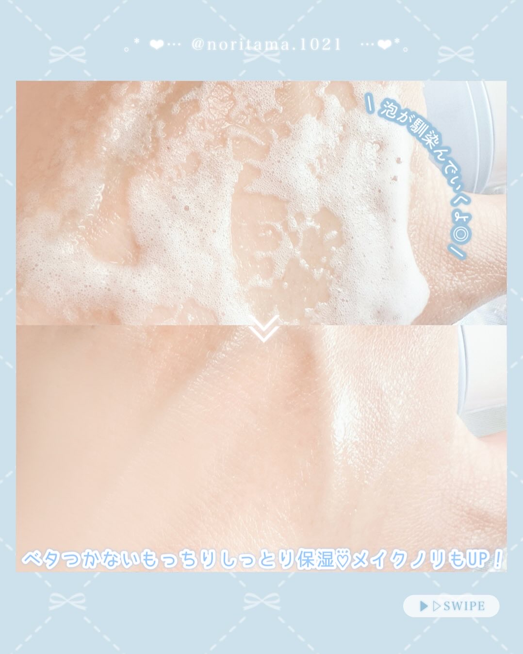 ブルービタミン バブルセラム エッセンス/SKIN SIGNAL/美容液を使ったクチコミ（3枚目）