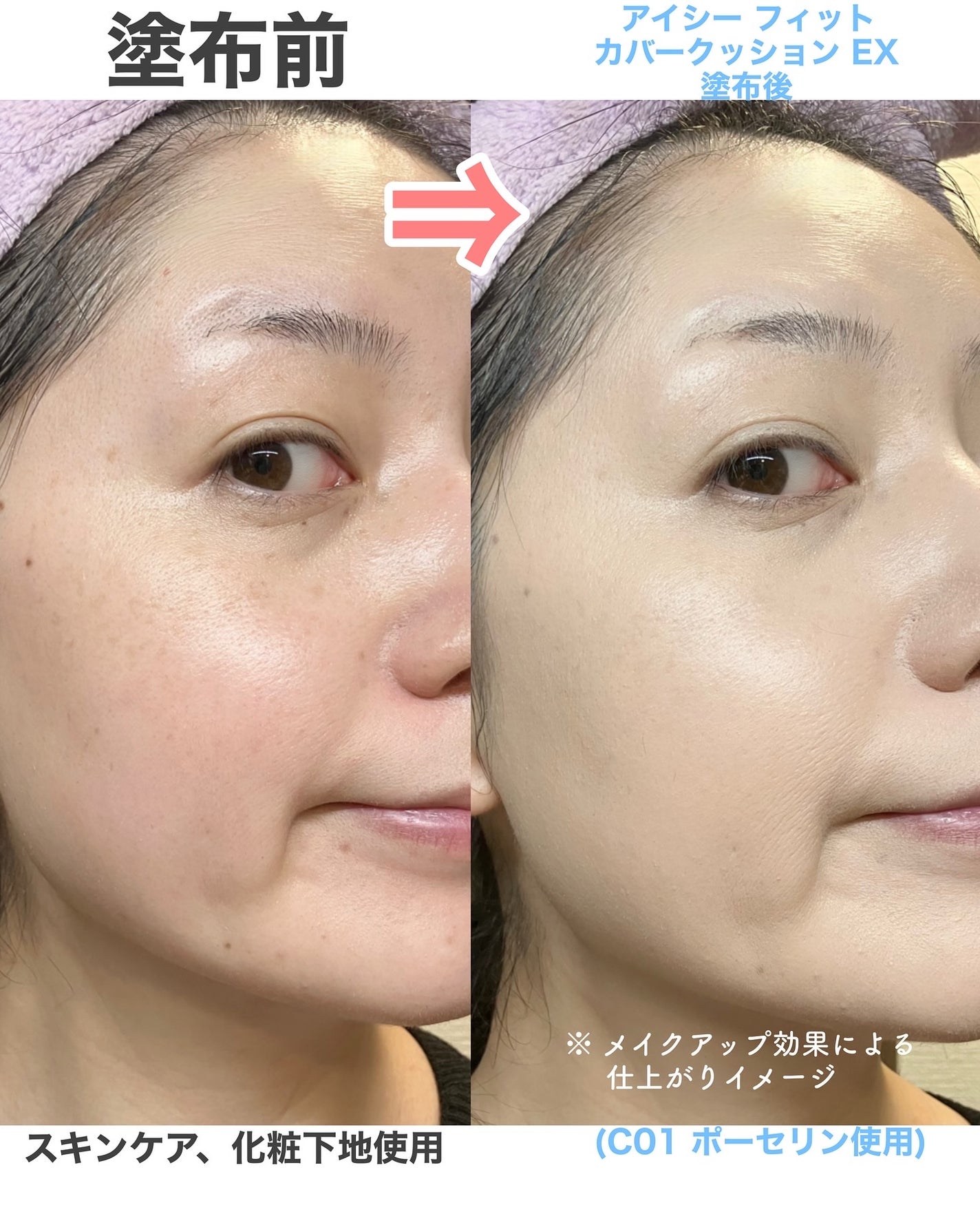 アイシーフィットカバークッションEX/TFIT/クッションファンデーションを使ったクチコミ(7枚目)