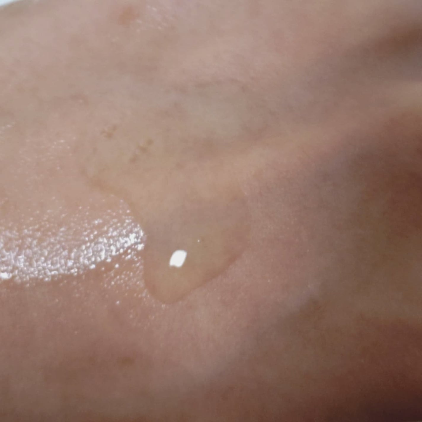 ベターツリカン肌荒れ美容液/Mildlab/美容液を使ったクチコミ(3枚目)