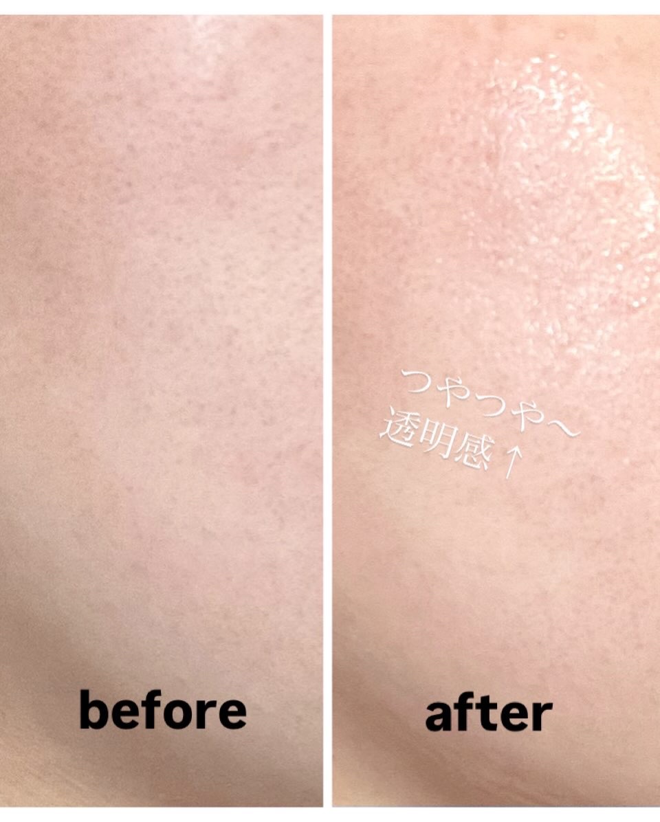 ヒソップモチパック/アレンシア/洗い流すパック・マスクを使ったクチコミ（3枚目）