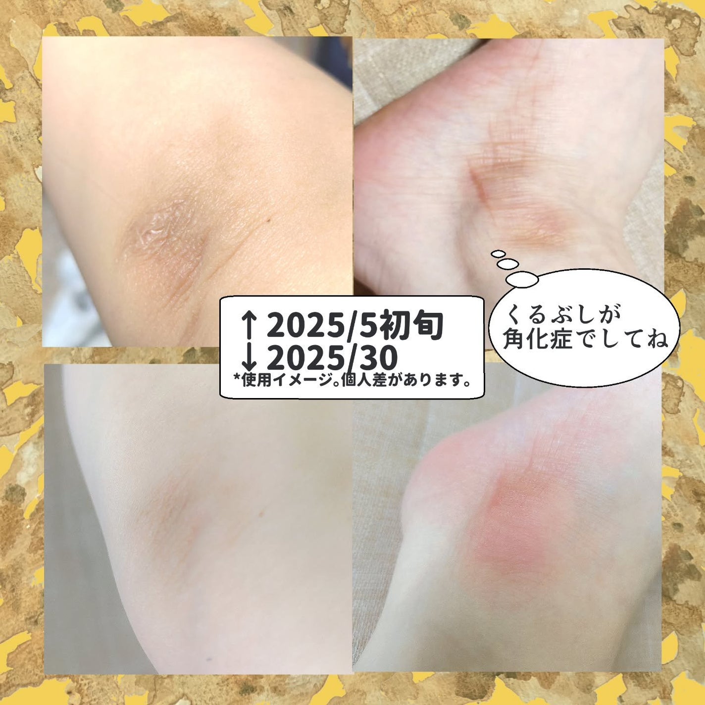 BnD マシュマロ コラーゲン AHA スクラブ /BnD/ボディスクラブを使ったクチコミ(3枚目)