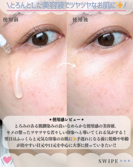 デュアル エフェクト アンプル/REJURAN COSMETICS/美容液を使ったクチコミ(5枚目)