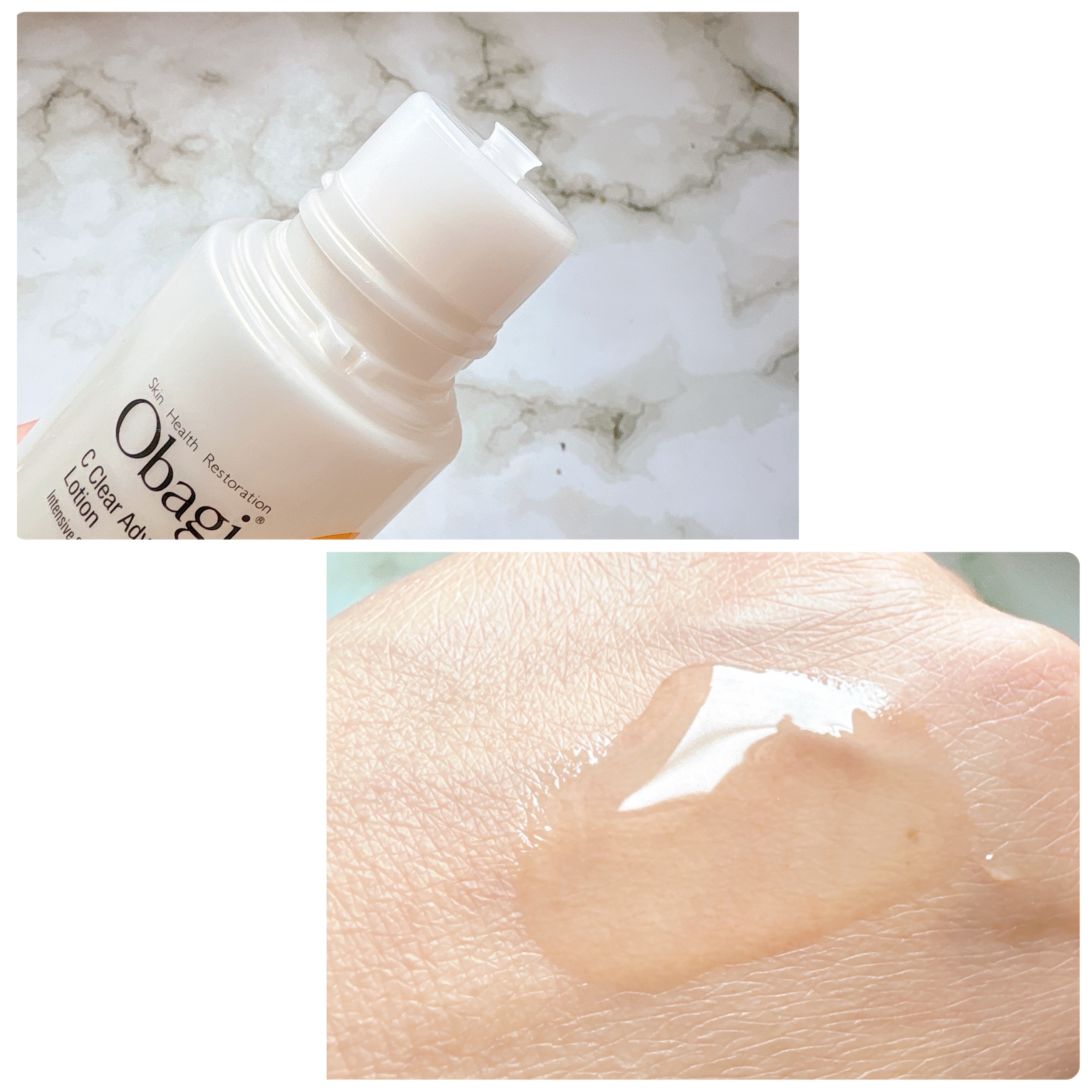 オバジC10セラム/オバジ/美容液を使ったクチコミ（3枚目）