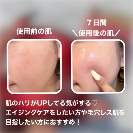 レッドモチセラム30/アレンシア/美容液を使ったクチコミ(6枚目)