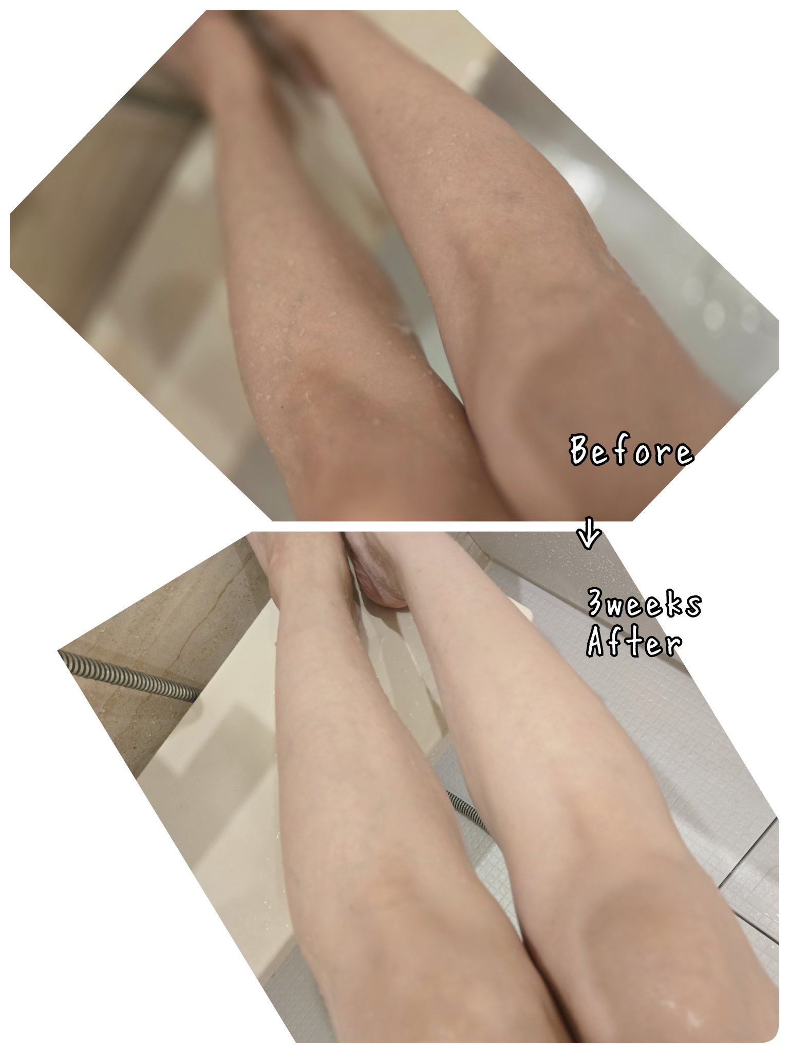 BnD マシュマロ コラーゲン AHA スクラブ /BnD/ボディスクラブを使ったクチコミ（3枚目）