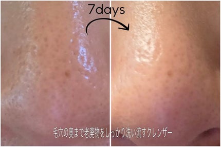 プレミアムもちソープ「グリーンアルティザン」/アレンシア/その他洗顔料を使ったクチコミ(3枚目)