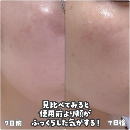 ホーリーヒソップ もちセラム/アレンシア/美容液を使ったクチコミ(3枚目)