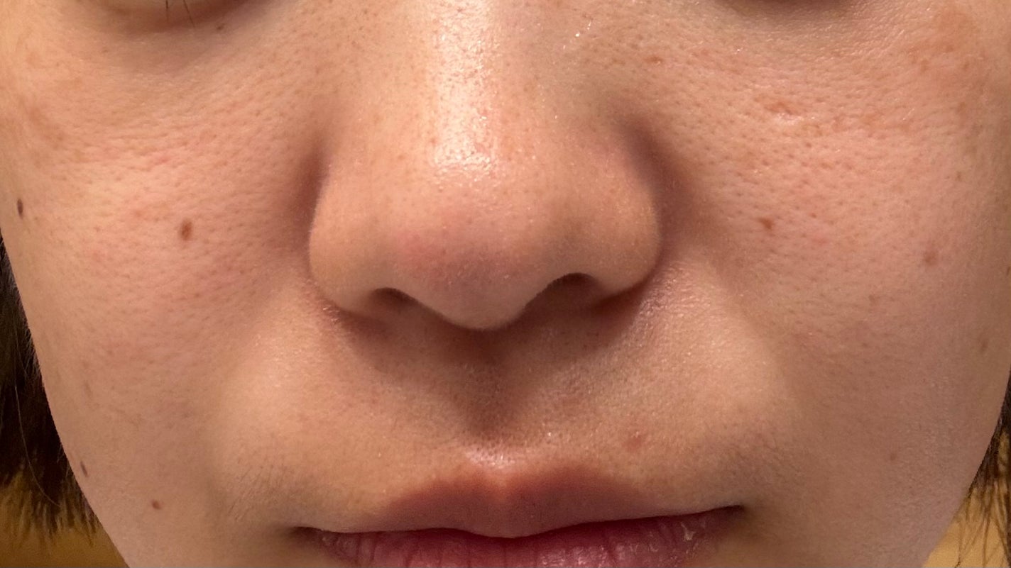 ハトムギ化粧水(ナチュリエ スキンコンディショナー R )/ナチュリエ/化粧水を使ったクチコミ(2枚目)