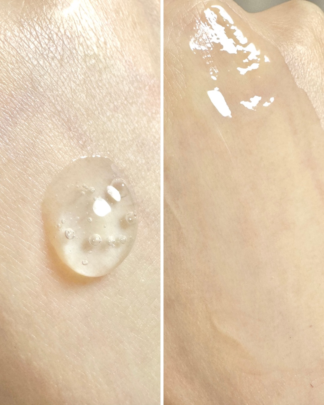 RTXセラム ヒアルショット/Dr.G/美容液を使ったクチコミ（3枚目）