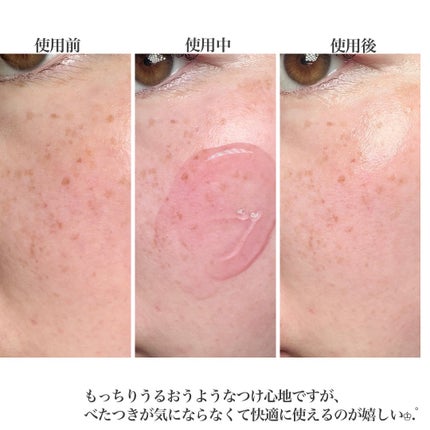 レッドモチセラム30/アレンシア/美容液を使ったクチコミ(5枚目)