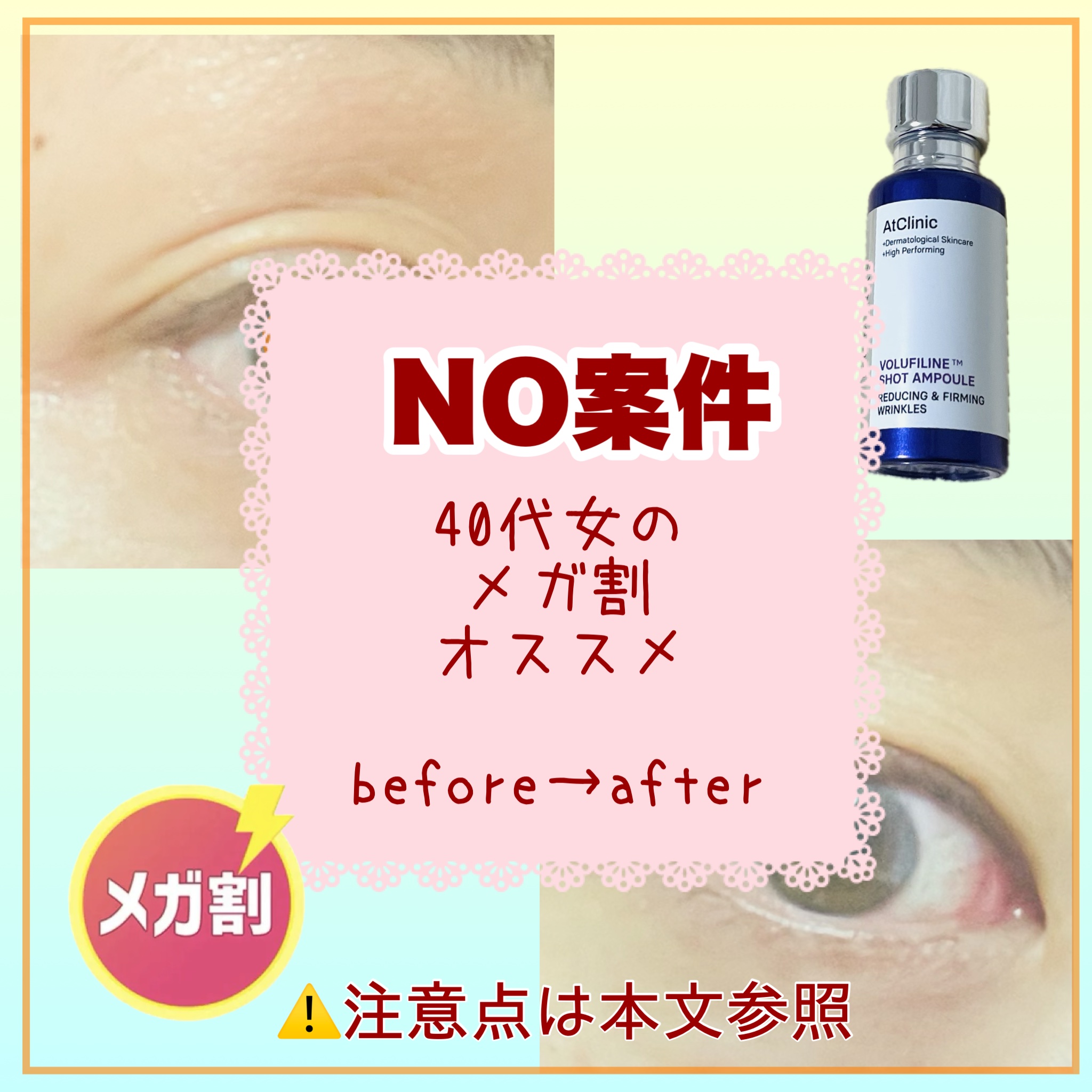 アットクリニックリンクルショットアンプル/DOMINAS/美容液を使ったクチコミ（1枚目）