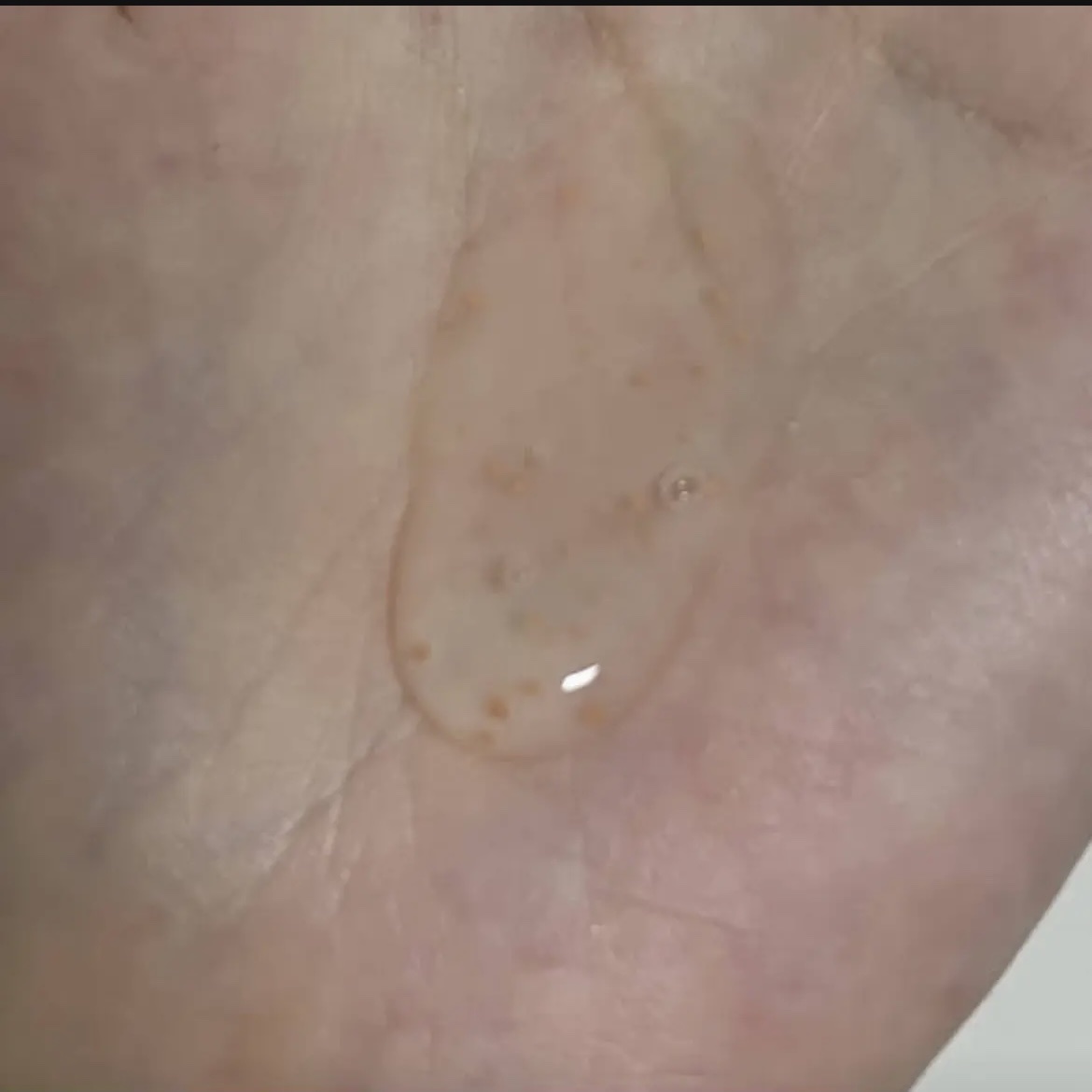 アビブ　グルタチオンソームダークスポットセラムビタドロップ/Abib /美容液を使ったクチコミ（3枚目）