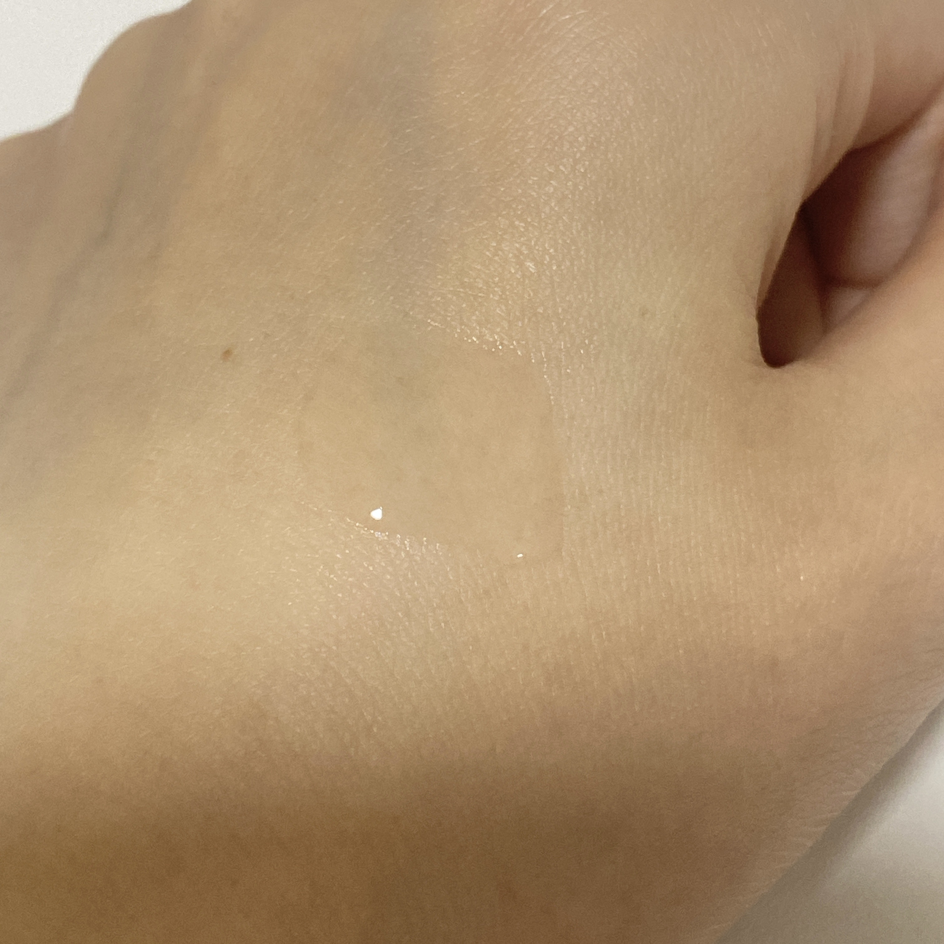 ジンクテカBセラムセット/BRING GREEN/スキンケアキットを使ったクチコミ（3枚目）