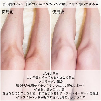 BnD マシュマロ コラーゲン AHA スクラブ /BnD/ボディスクラブを使ったクチコミ(4枚目)