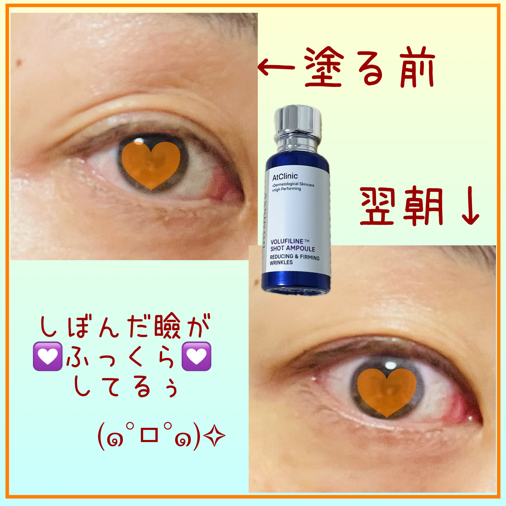 アットクリニックリンクルショットアンプル/DOMINAS/美容液を使ったクチコミ（2枚目）