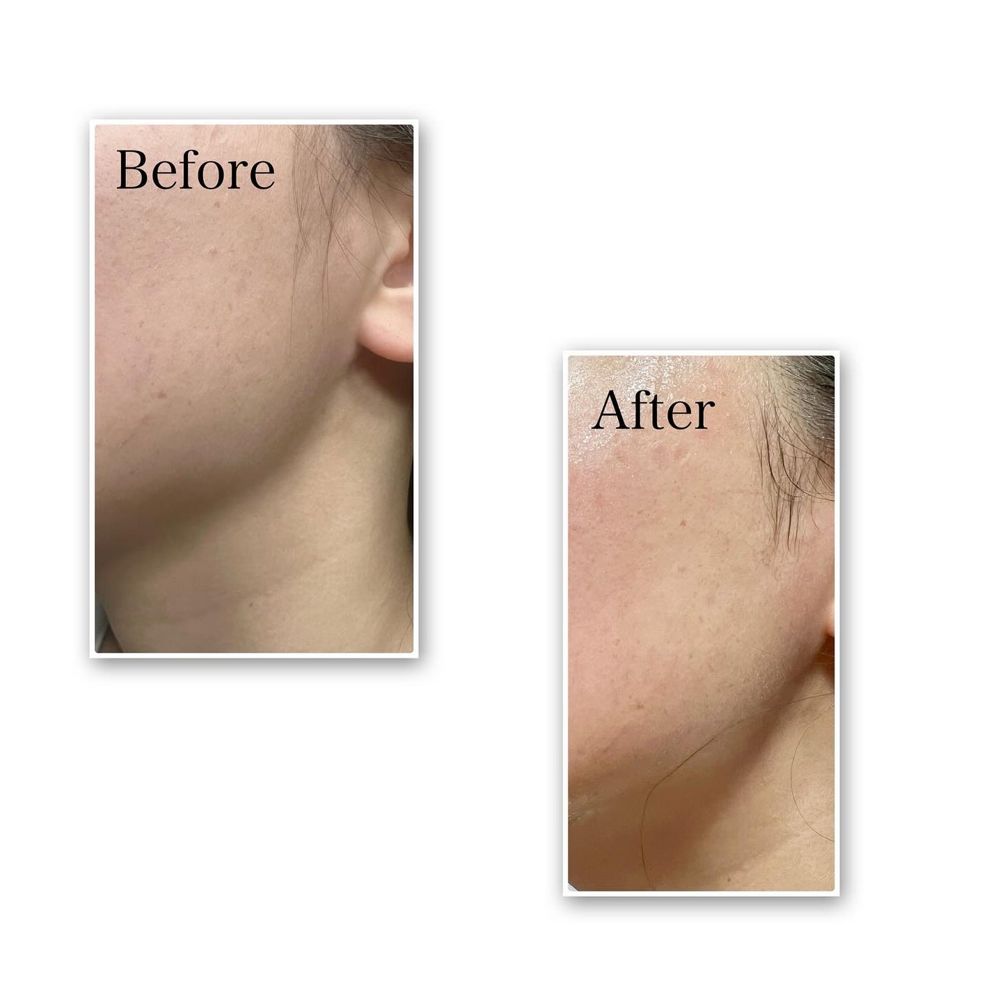 SeRi フォロバ100 on LIPS 「・Arencia@arencia_jpヒソップもちパック..」(4枚目)