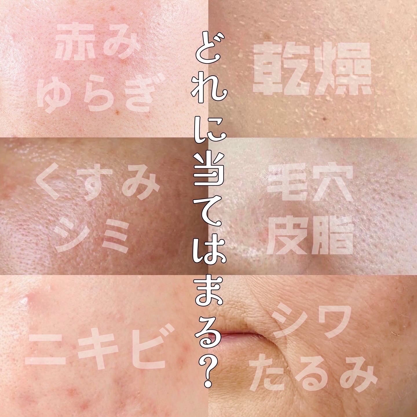 センテラ アンプル/SKIN1004/美容液を使ったクチコミ（2枚目）