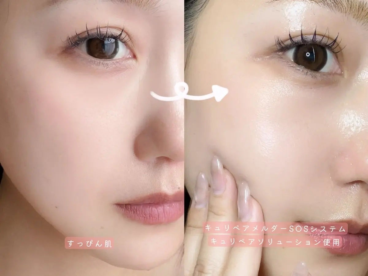 SOSメルダーシステム/KOPHER/フェイスクリームを使ったクチコミ(3枚目)