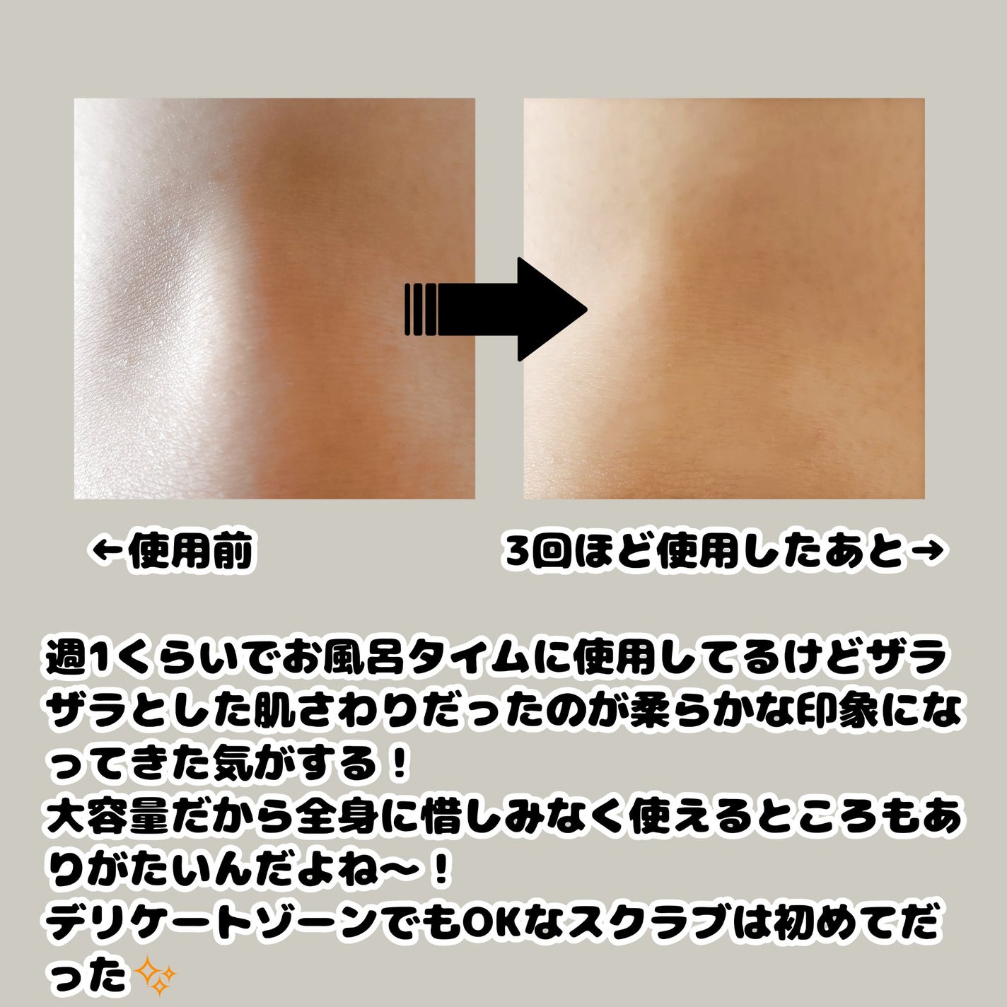 BnD マシュマロ コラーゲン AHA スクラブ /BnD/ボディスクラブを使ったクチコミ(4枚目)