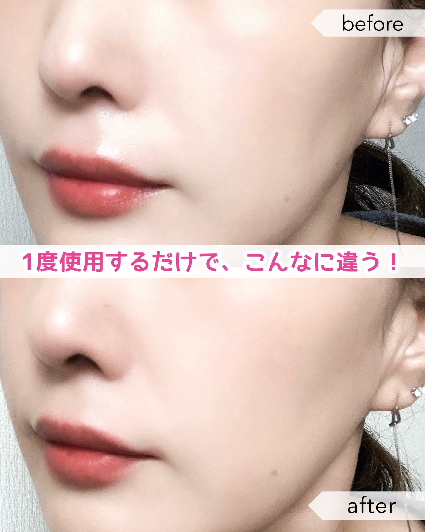 レッドモチセラム30/アレンシア/美容液を使ったクチコミ(4枚目)