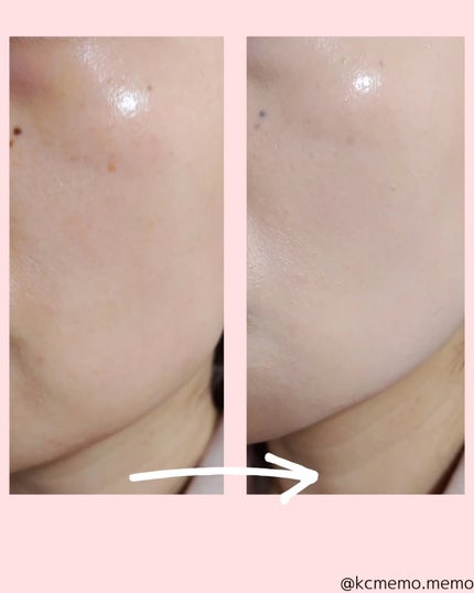 Make Me Fitting Cushion/Likebel/クッションファンデーションを使ったクチコミ(5枚目)