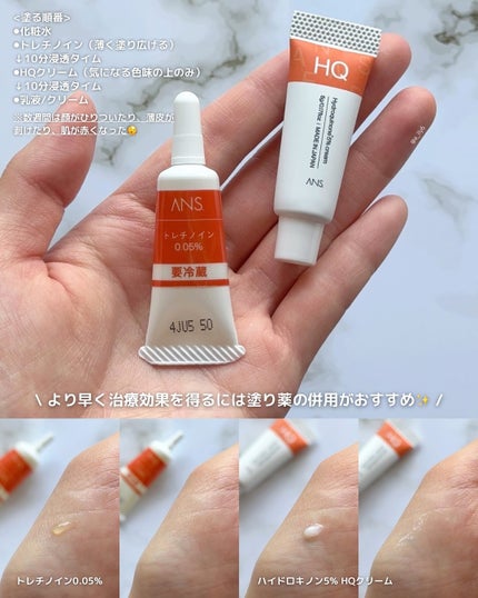 ããã㌠ðð€ãã©ãã on LIPS ããå
åŽããã®èã±ã¢ãçŸèæ²»ç1ã¶æè©ŠããŠã¿ãð§¡ÂŽ-â¡#ANSâ¡..ãïŒ5æç®ïŒ