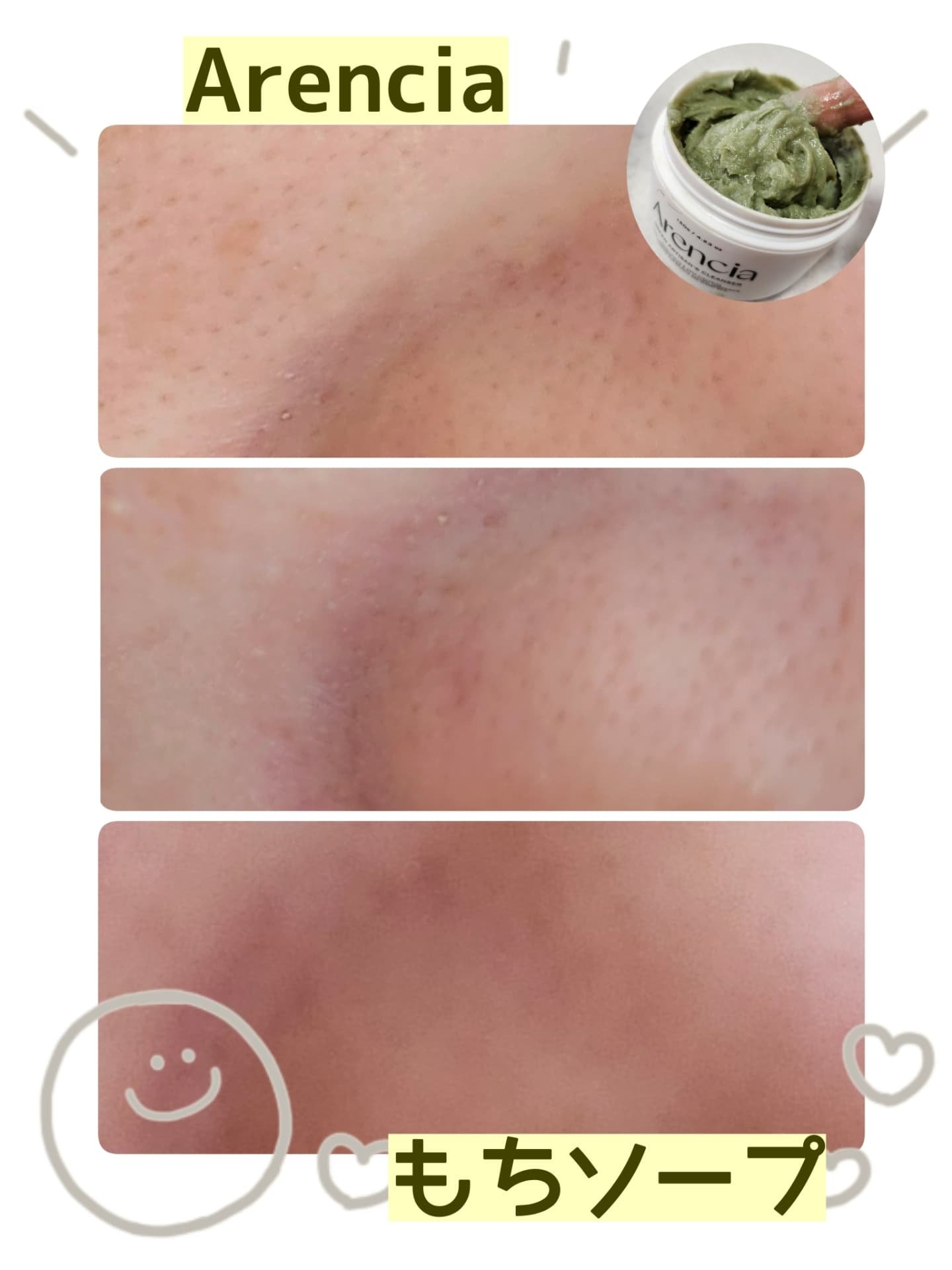 プレミアムもちソープ「グリーンアルティザン」/アレンシア/その他洗顔料を使ったクチコミ（1枚目）