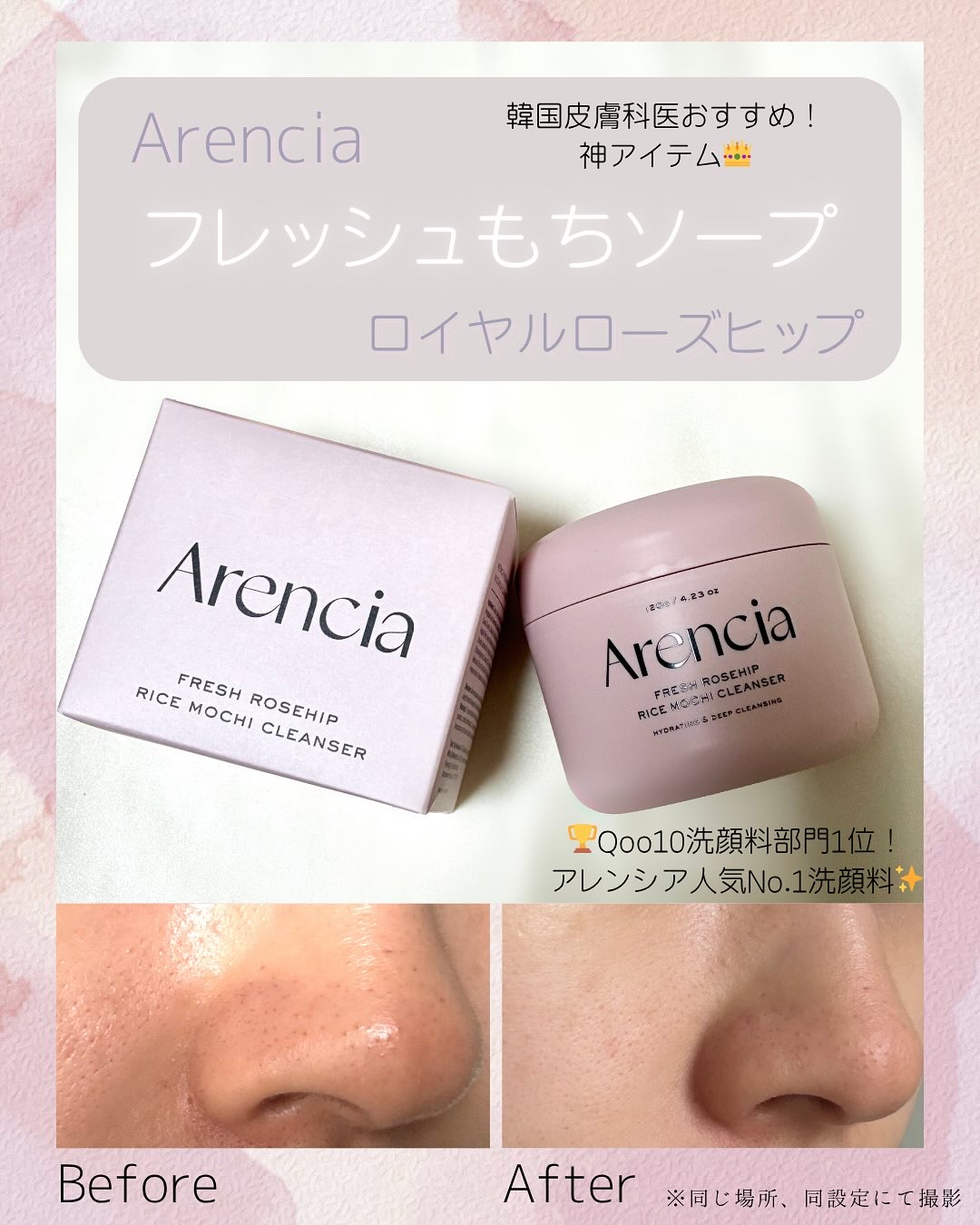 アレンシアフレッシュもちソープ「ロイヤルローズヒップ」/アレンシア/その他洗顔料を使ったクチコミ（1枚目）