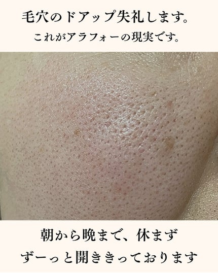 トリプル レチノール ウォッシュピール/Celladix/ピーリングを使ったクチコミ(2枚目)