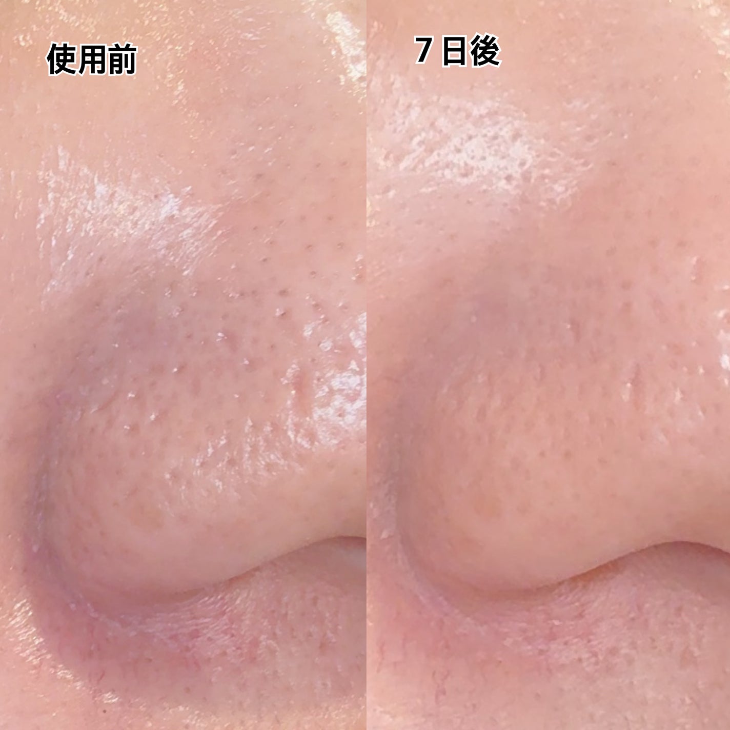 プレミアムもちソープ「グリーンアルティザン」/アレンシア/その他洗顔料を使ったクチコミ(6枚目)