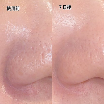 プレミアムもちソープ「グリーンアルティザン」/アレンシア/その他洗顔料を使ったクチコミ(6枚目)