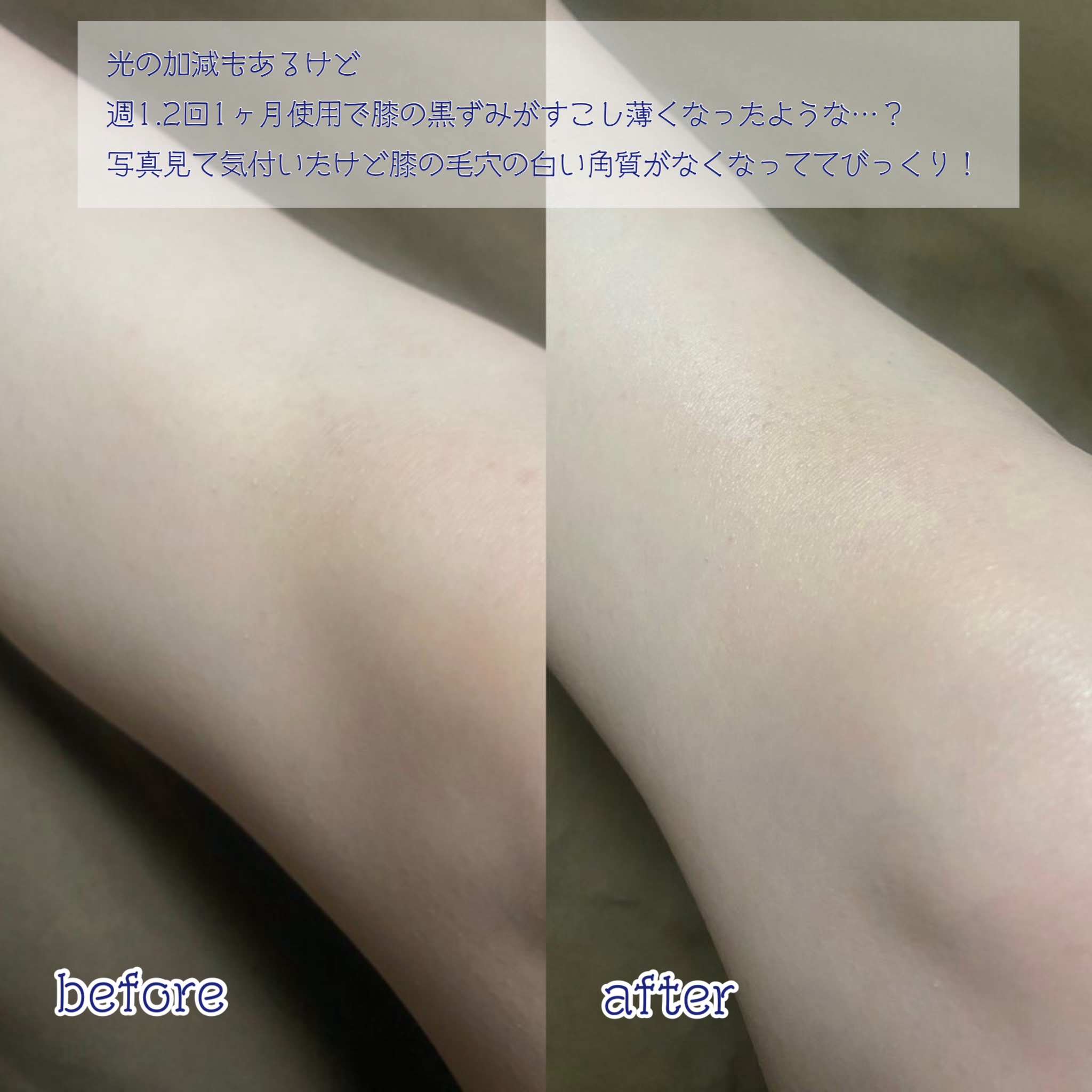 BnD マシュマロ コラーゲン AHA スクラブ /BnD/ボディスクラブを使ったクチコミ（3枚目）