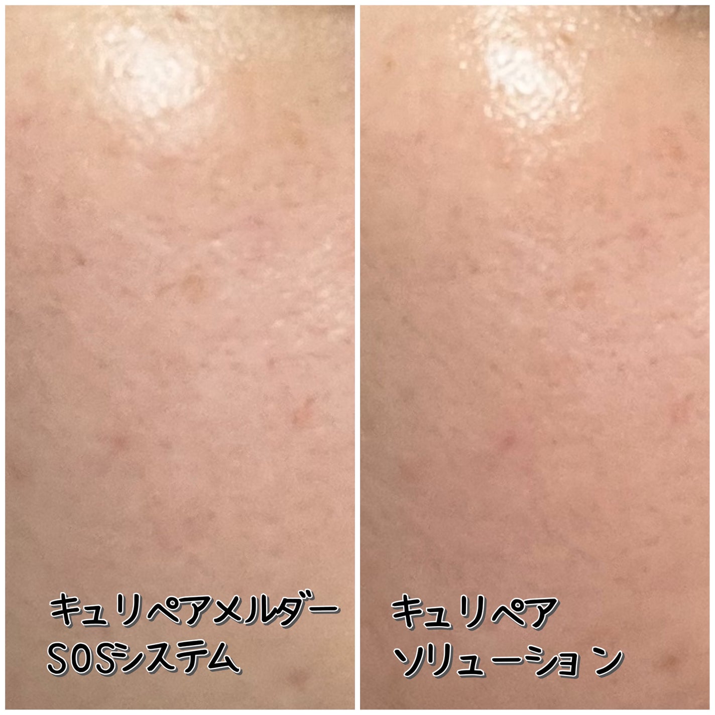 SOSメルダーシステム/KOPHER/フェイスクリームを使ったクチコミ(2枚目)