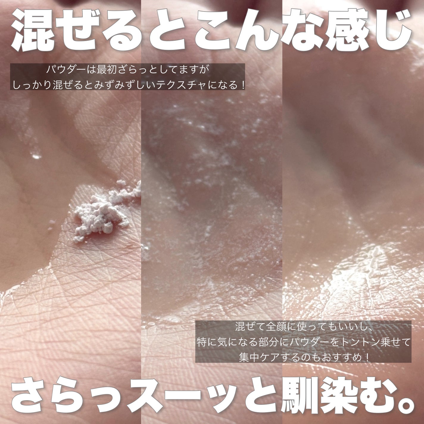 ジンクテカBセラムセット/BRING GREEN/スキンケアキットを使ったクチコミ(4枚目)