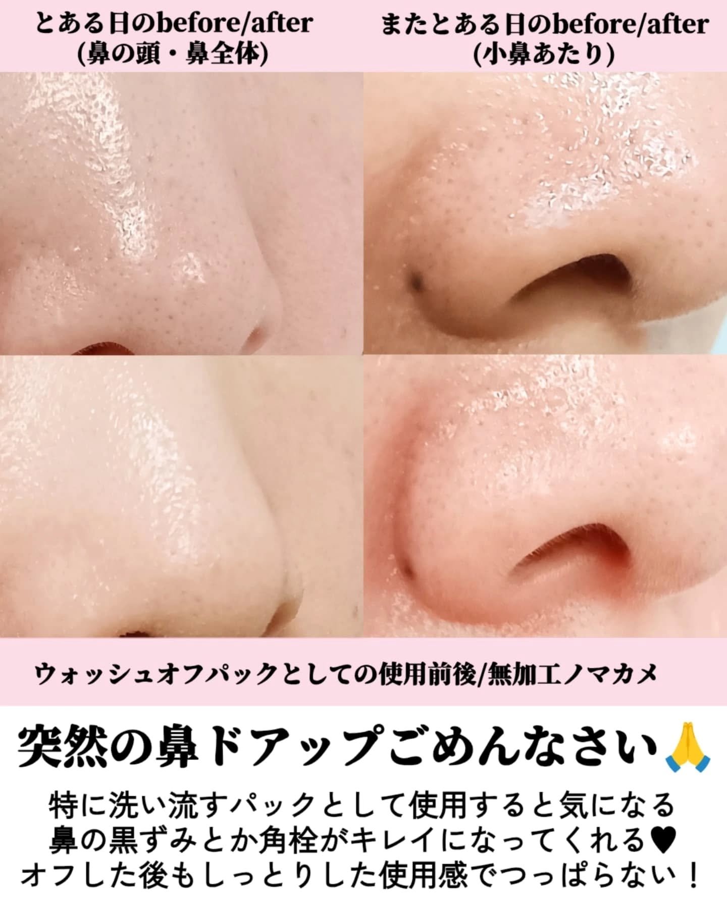 アレンシアフレッシュもちソープ「ロイヤルローズヒップ」/アレンシア/その他洗顔料を使ったクチコミ（2枚目）