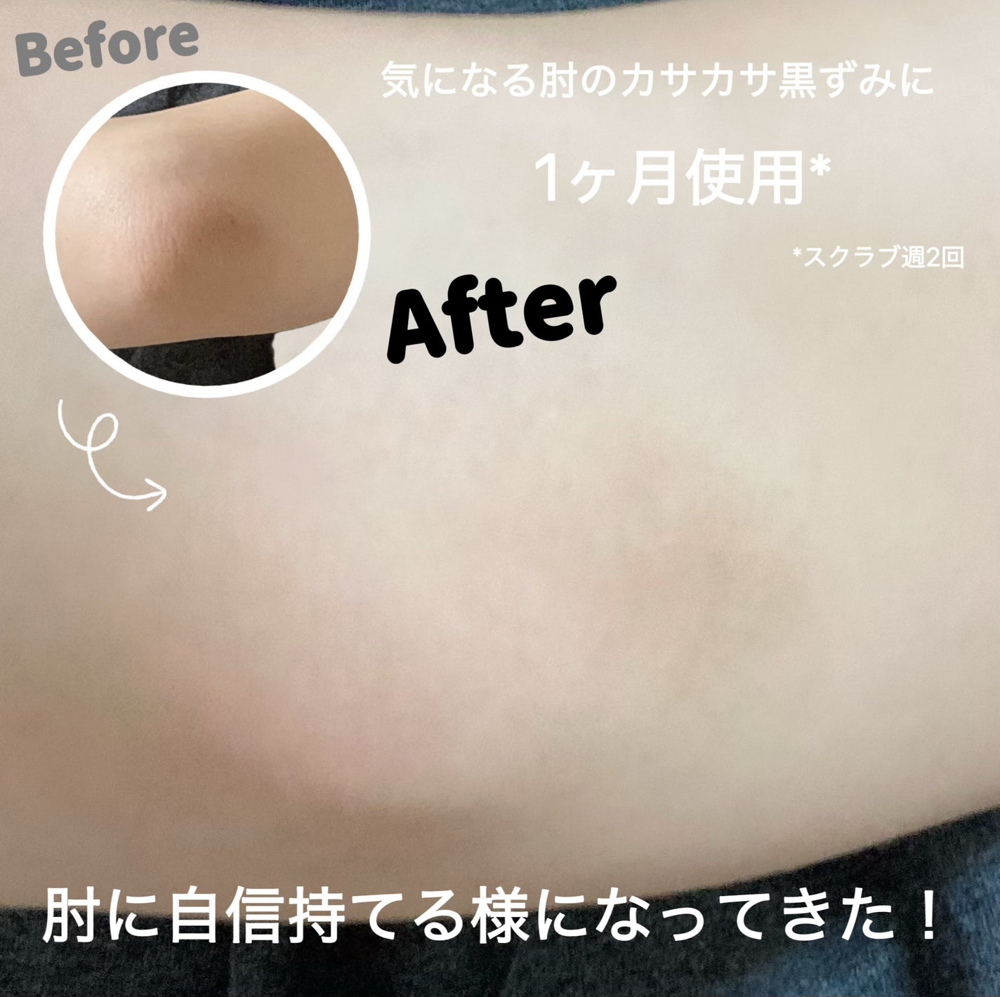 BnD マシュマロ コラーゲン AHA スクラブ /BnD/ボディスクラブを使ったクチコミ(4枚目)