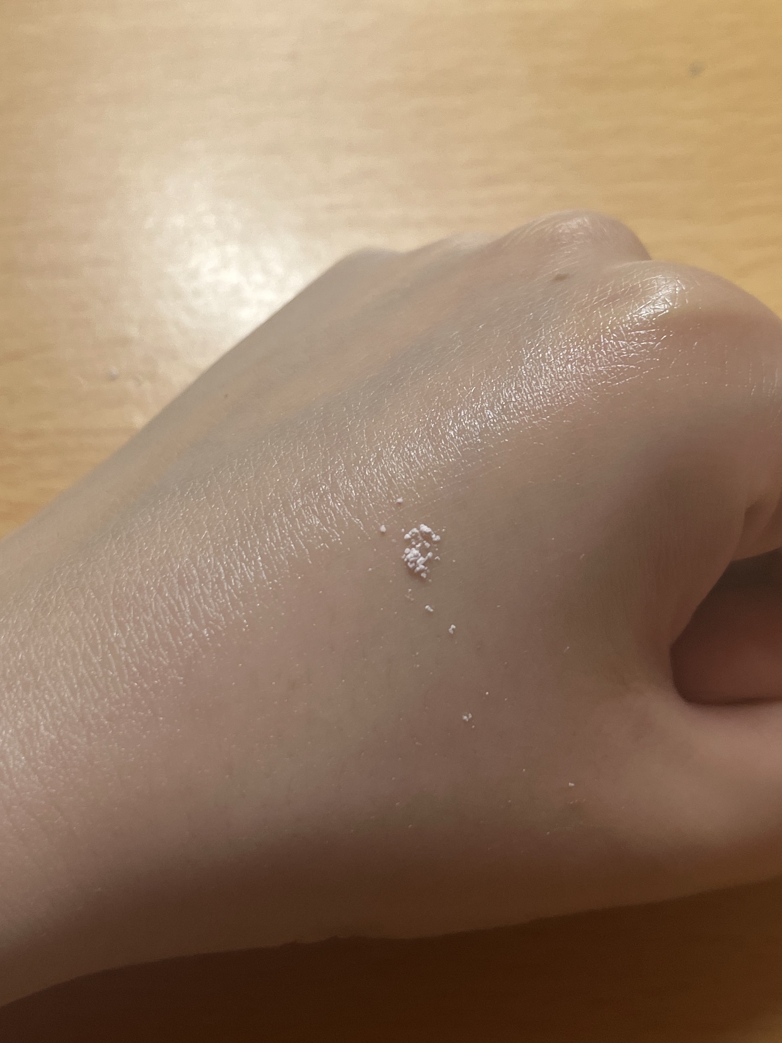 ジンクテカBセラムセット/BRING GREEN/スキンケアキットを使ったクチコミ（3枚目）