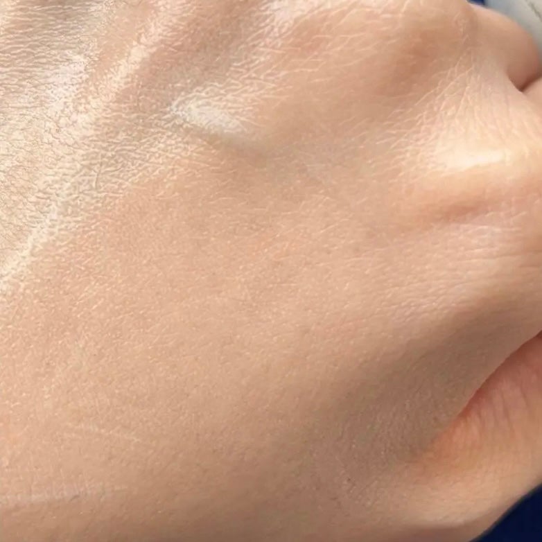 リードルS PDRN+ セラム/VT/美容液を使ったクチコミ(3枚目)