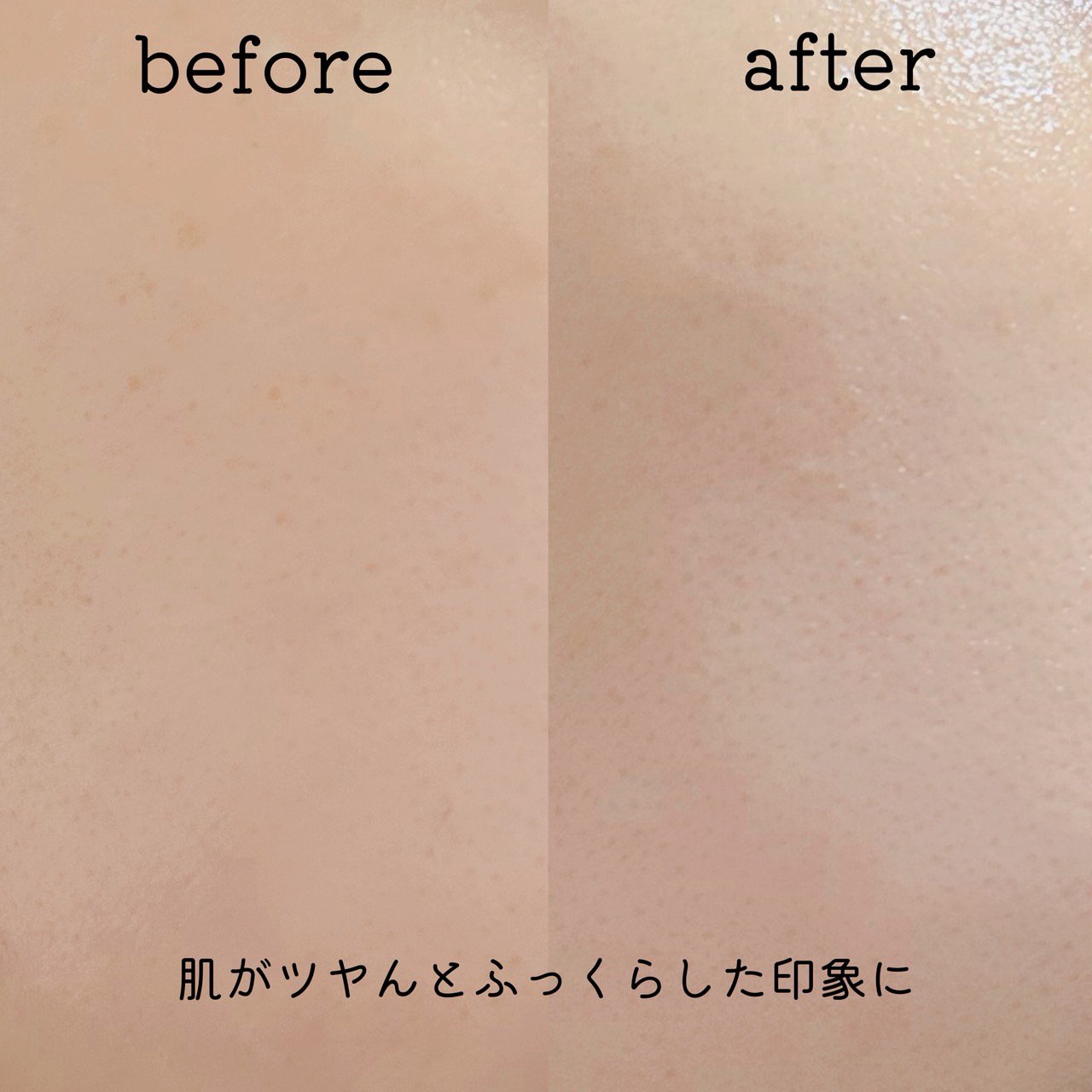 レッドモチセラム30/アレンシア/美容液を使ったクチコミ（3枚目）