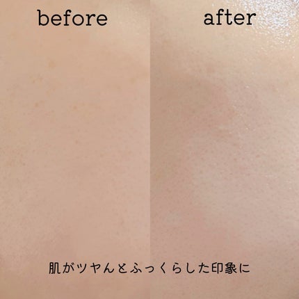 レッドモチセラム30/アレンシア/美容液を使ったクチコミ(3枚目)